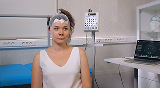 Successful Long-Term EEG Monitoring with Cup Electrodes | Guide